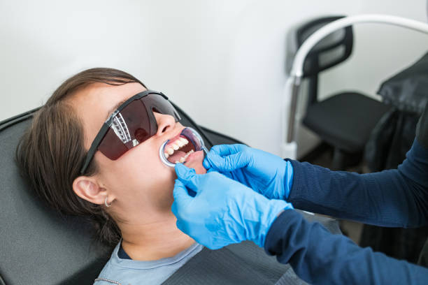 Best Knocked-Out Tooth (Avulsed Tooth) Treatment in Holly Hill, FL